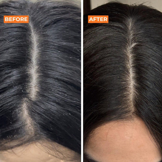 Organic Hair Shampoo - MYOB